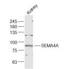 Anti-SEMA4A antibody