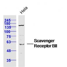 Anti-Scavenger Receptor BII antibody