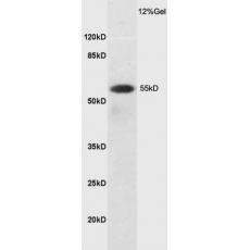 Anti-SLC7A5 antibody