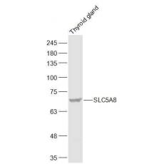 Anti-SLC5A8 antibody