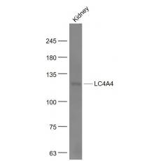 Anti-SLC4A4 antibody