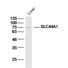 Anti-SLC44A1 antibody