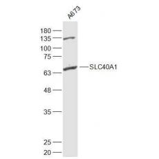 Anti-SLC40A1 antibody