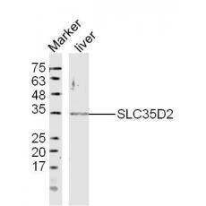 Anti-SLC35D2 antibody