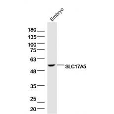 Anti-SLC17A5 antibody