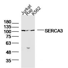 Anti-SERCA3 antibody