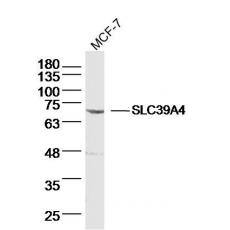 Anti-SLC39A4 antibody