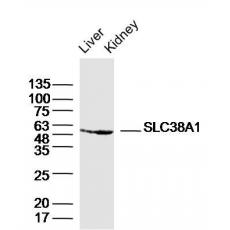 Anti-SLC38A1 antibody