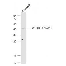 Anti-SERPINA12 antibody