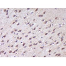 Anti-RUSC1 antibody