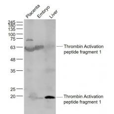 Anti-Thrombin Activation peptide fragment 1 antibody