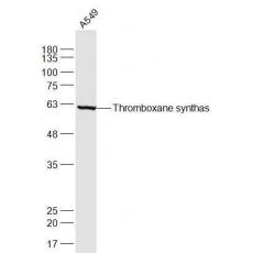Anti-Thromboxane synthase antibody