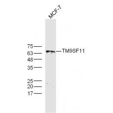 Anti-TM9SF1 antibody
