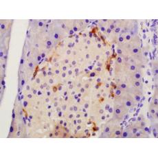 Anti-TMEM49 antibody