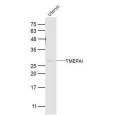 Anti-TMEPAI antibody