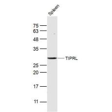 Anti-TIPRL antibody