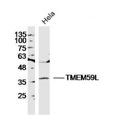 Anti-TMEM59L antibody