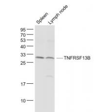 Anti-TNFRSF13B antibody