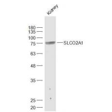 Anti-SLCO2A1 antibody