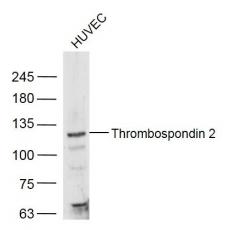 Anti-Thrombospondin 2 antibody