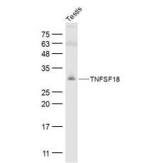 Anti-TNFSF18 antibody