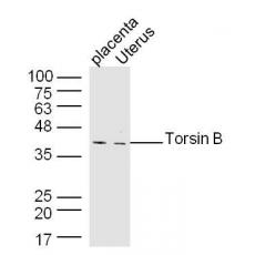 Anti-Torsin B antibody