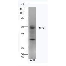 Anti-TNIP2 antibody