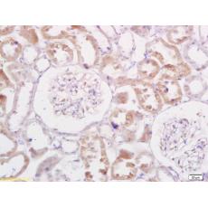 Anti-TRADD antibody