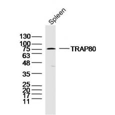 Anti-TRAP80 antibody