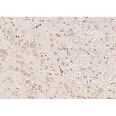 Anti-TREM2 antibody
