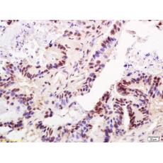 Anti-TRF2 antibody