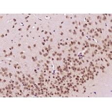 Anti-TRF1 antibody