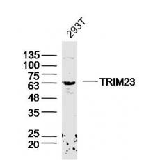 Anti-TRIM23 antibody