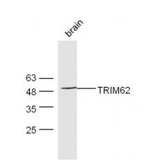 Anti-TRIM62 antibody