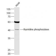 Anti-thymidine phosphorylase antibody