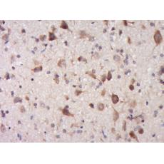 Anti-TRIM68 antibody
