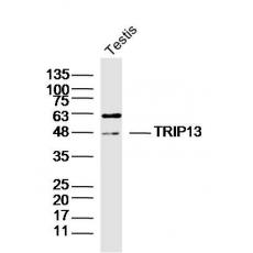 Anti-TRIP13 antibody