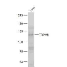 Anti-TRPM5 antibody