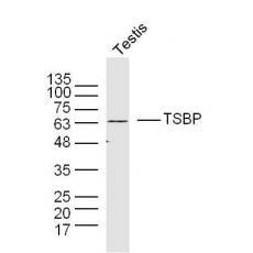 Anti-TSBP antibody