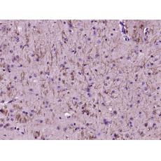 Anti-TSLC1 antibody
