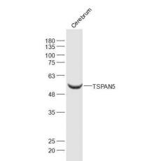 Anti-TSPAN5 antibody
