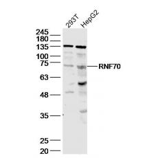 Anti-RNF70 antibody