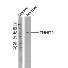 Anti-ZNHIT2 antibody