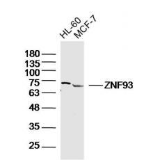 Anti-ZNF93 antibody