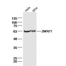Anti-ZNF671 antibody