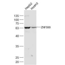 Anti-ZNF599 antibody