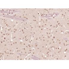 Anti-ZNF312 antibody