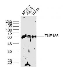 Anti-ZNF185 antibody