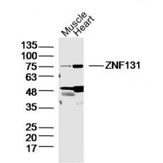Anti-ZNF131 antibody