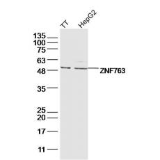 Anti-ZNF763 antibody